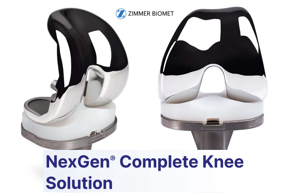 Zimmer Biomet Nexgen Knee Implant