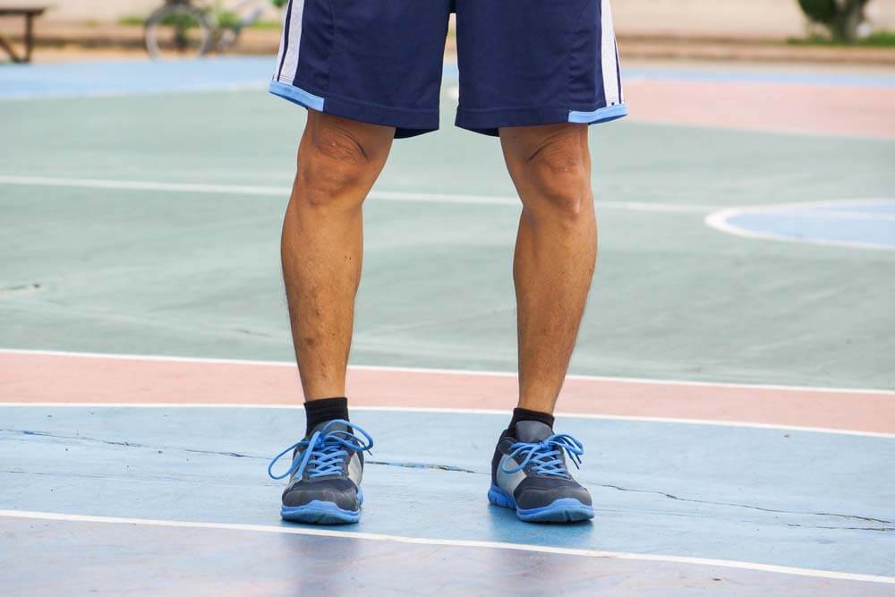 Man with Bow Legs