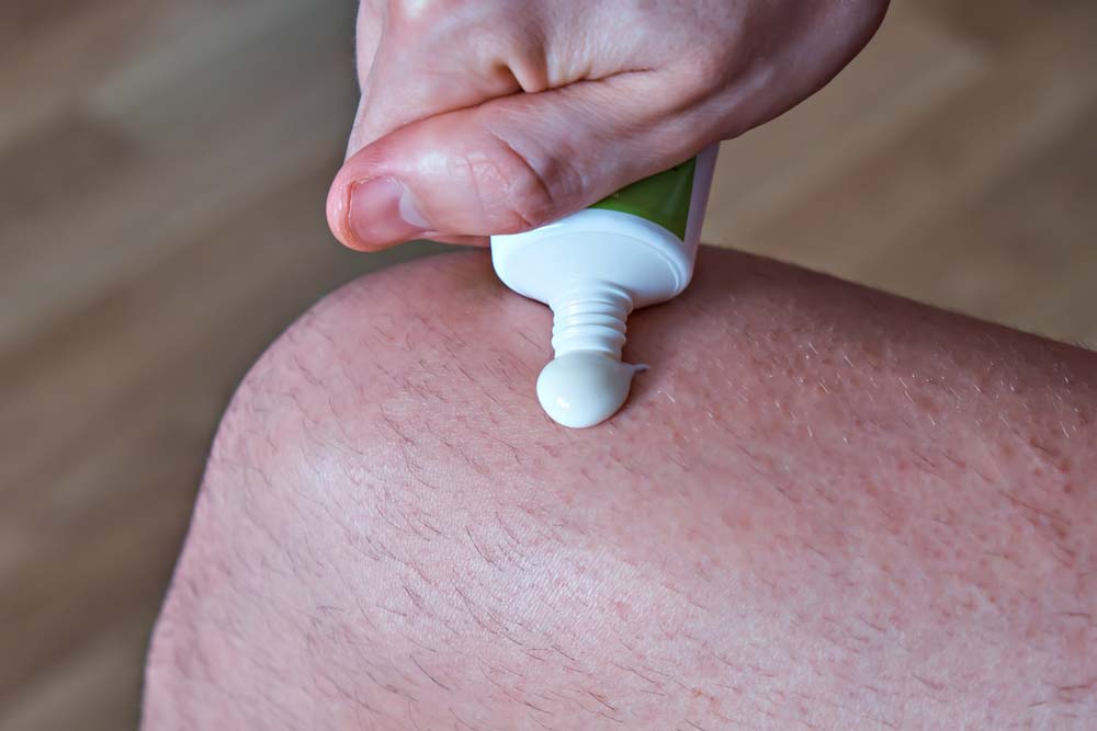 Man Putting Anti-Inflammatory Cream on Knee